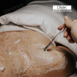 DMK Enzyme Therapy – Liệu trình trẻ hóa da độc đáo